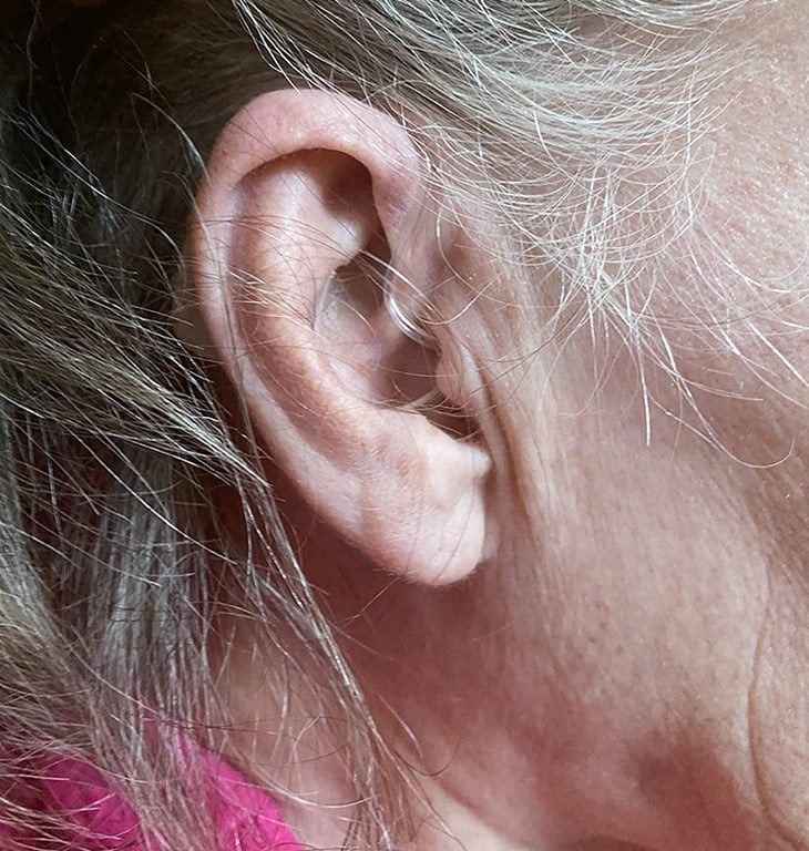 Oricle hearing aid worn discreetly in a person's ear