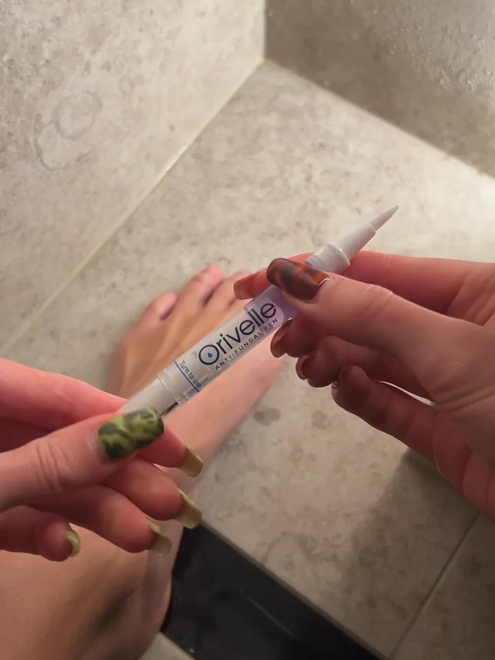 Using the Orivelle Anti-Fungal Pen on a discolored toenail
